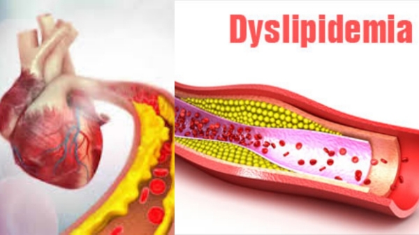 Health Heart Diseases