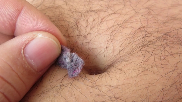 health cotton bacteria