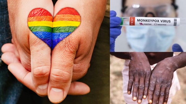 Monkey Pox Virus WHO lgbtq