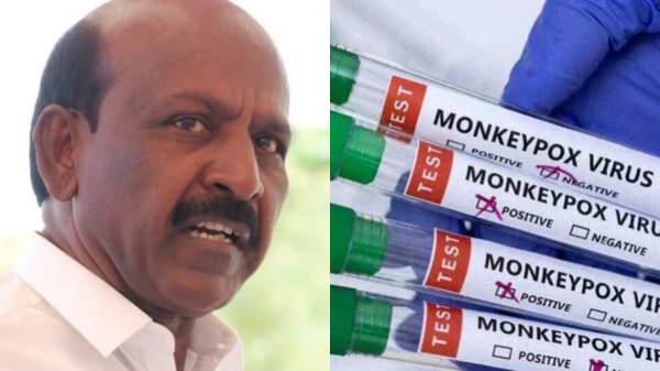 Monkeypox Ma subramaniyan Monkeypox Ma subramaniyan