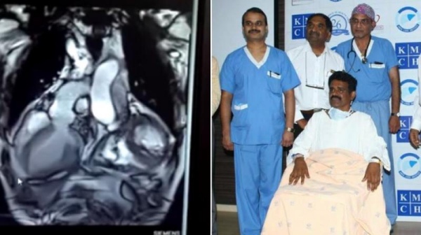 Coimbatore health