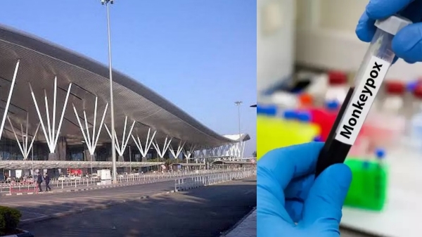 bangalore monkeypox monkeypox virus bangalore monkeypox monkeypox virus