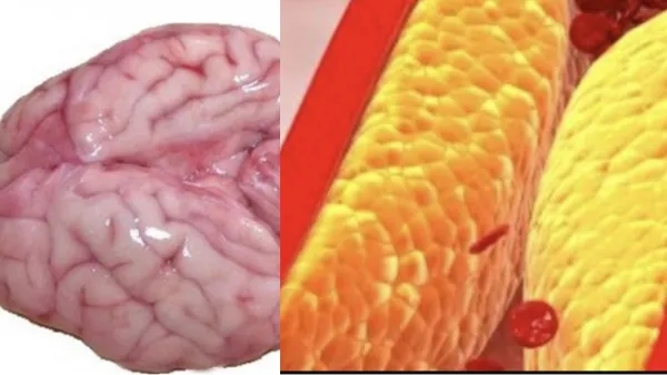 mutton mutton brain goat brain mutton mutton brain goat brain