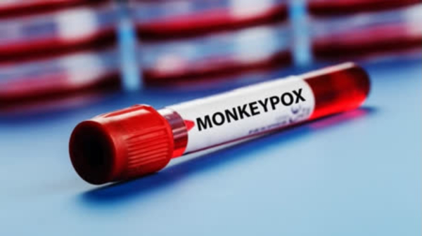 monkeypox monkeypox virus kerala
