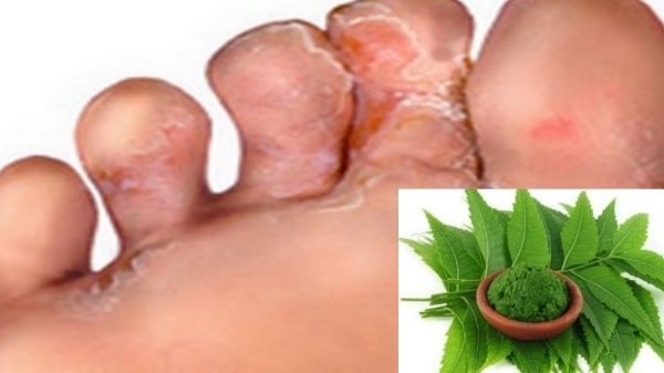 neem leaves neem leaves