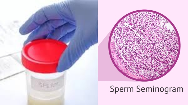 sperm reproduction delhi high court