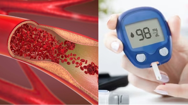 sugar patients diabetics