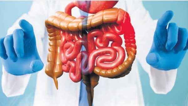 colon cancer
