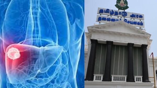 liver cancer jaundice vaccine tn government