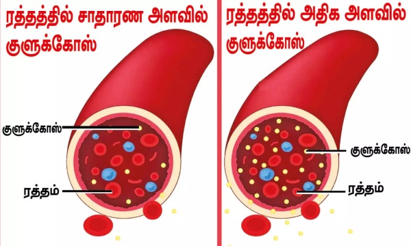 sugar patients banana diabetics sugar patients banana diabetics
