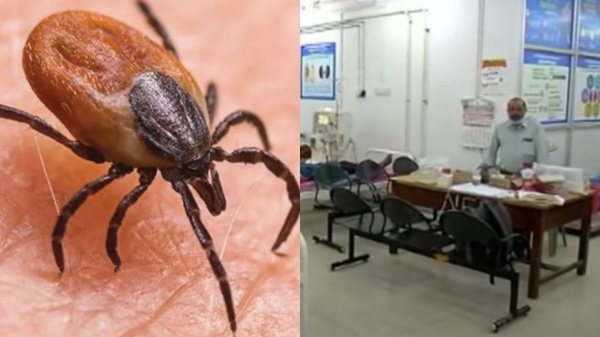 scrub typhus virus chennai