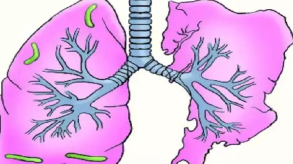 lungs respiratory diseases turmeric lungs respiratory diseases turmeric