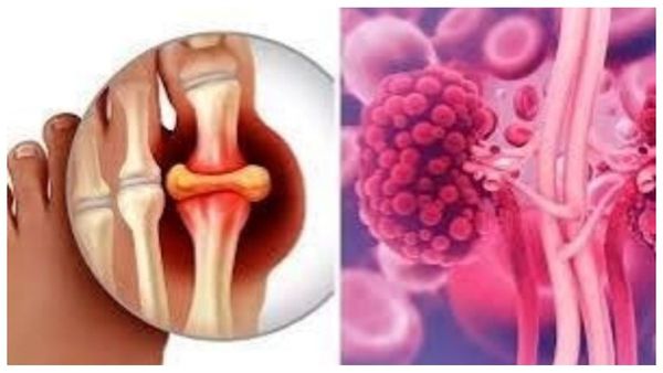 excessive salt health risks hypertension heart disease sodium intake