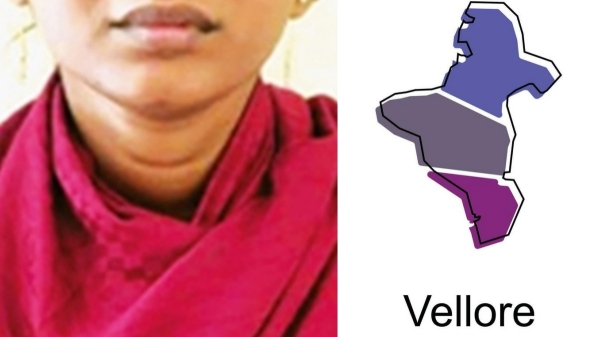 Vellore Government Hospital physically challenged Vellore Government Hospital physically challenged
