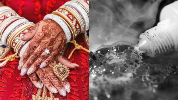 Ex-Girlfriend Marriage Acid thrown Ex-Girlfriend Marriage Acid thrown