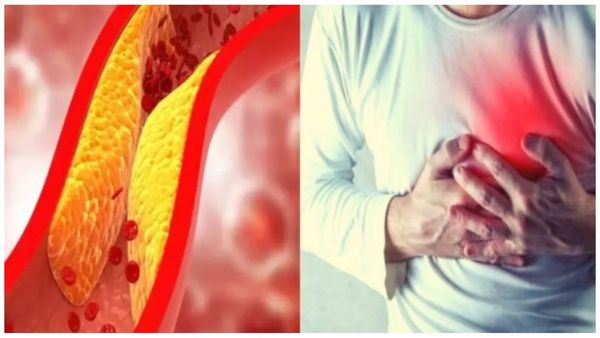 Plums Fruits Aloo Bukhara Plums Fruits Aloo Bukhara