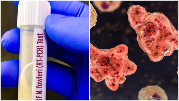 Brain US Woman Brain US Woman