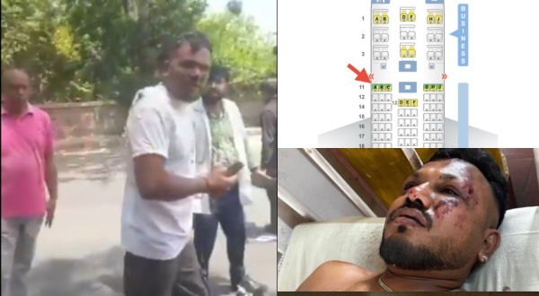 Ahmedabad Air India Plane Crash Where did the lone survivor stay for a long time amid the rescue operation Ahmedabad Air India Plane Crash Where did the lone survivor stay for a long time amid the rescue operation
