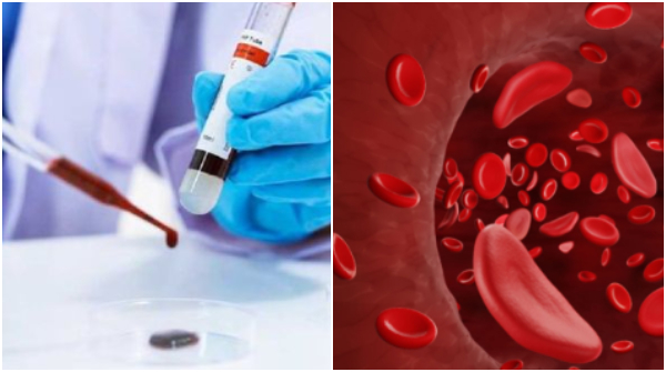 Japan s Breakthrough Universal Artificial Blood for All Types Lasts Up to 2 Years