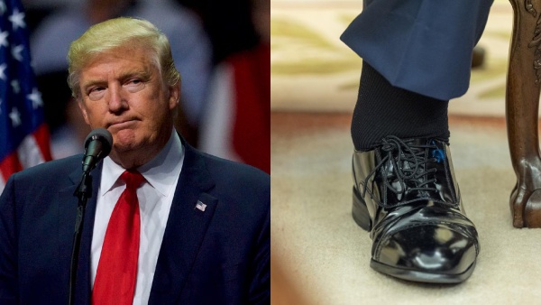 donald-trump-suffering-from-chronic-venous-insufficiency