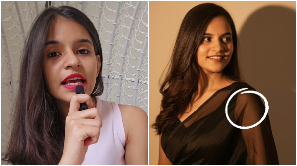 Google Gemini Nano Banana AI Saree Trend Woman s Creepy Mole Discovery Why it sparked concern Google Gemini Nano Banana AI Saree Trend Woman s Creepy Mole Discovery Why it sparked concern