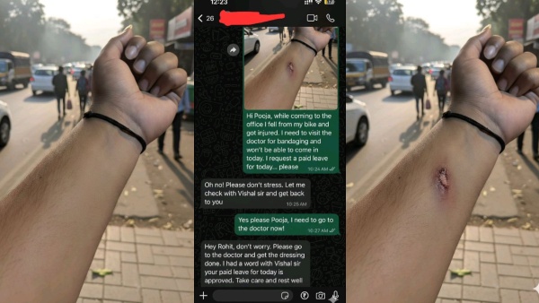 employee-uses-googles-nano-banana-ai-tool-to-fake-injury-and-got-paid-leave