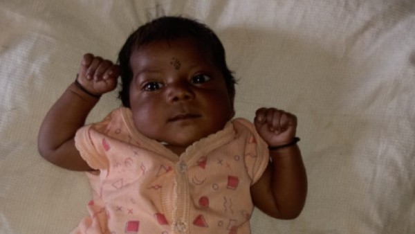 heart disease Krishnagiri heart defect surgery heart disease Krishnagiri heart defect surgery