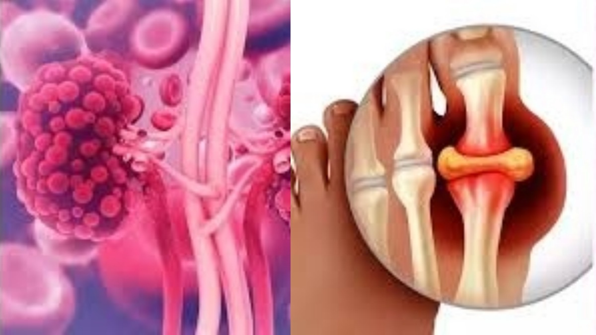 பெருவிரலில் வலி ஏன் வருகிறது? இந்த அறிகுறிகளை கவனிக்காமல் விட்டால் ஆபத்து