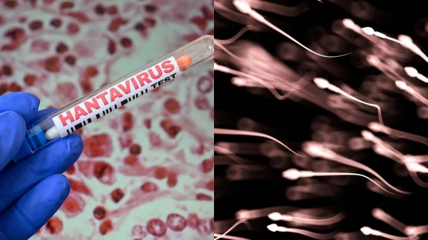 Hantavirus Semen Persistence