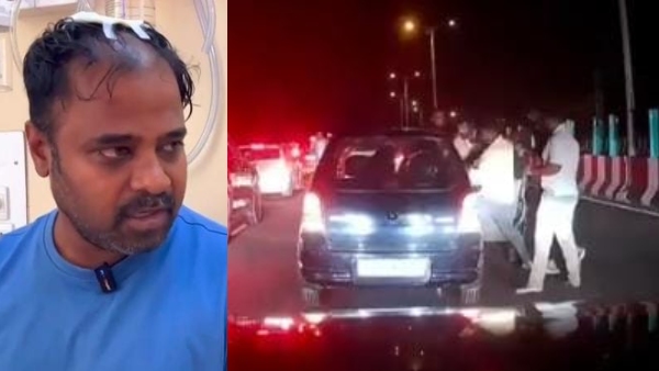 bengaluru-mysuru-expressway-victim-says-that-my-wife-folded-hands-and-wants-to-offers-gold-to-atta bengaluru-mysuru-expressway-victim-says-that-my-wife-folded-hands-and-wants-to-offers-gold-to-atta