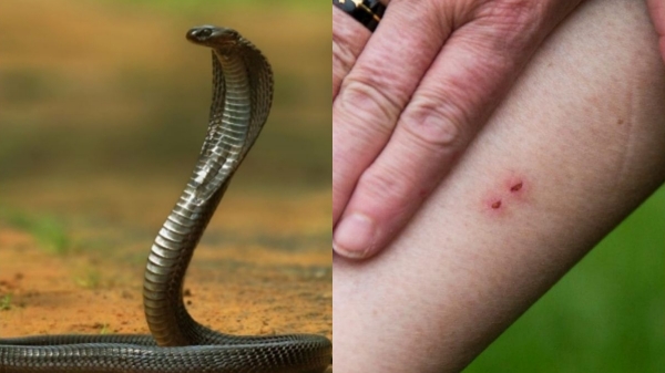 health dr Farook abdulla snake health dr Farook abdulla snake