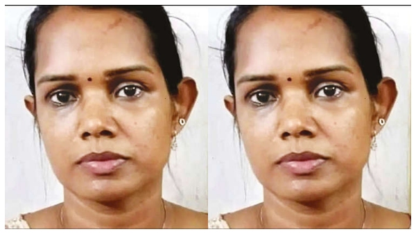 Thiruvananthapuram Businessman Young woman swindles 5 crore with the help of friends Thiruvananthapuram Businessman Young woman swindles 5 crore with the help of friends