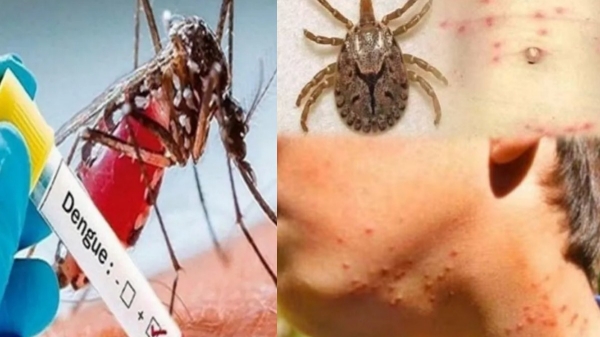 Anna University fever dengue Anna University fever dengue