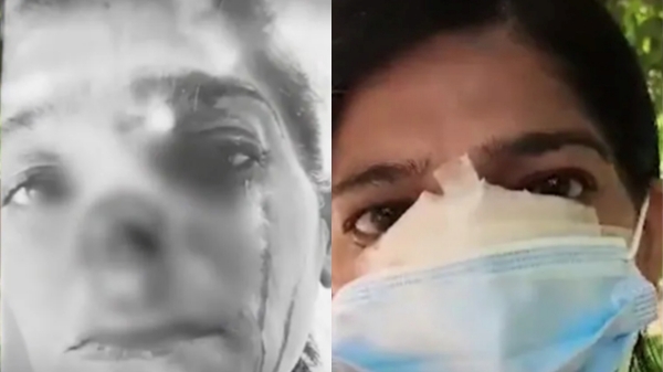 Monica Mathura Nose Ring