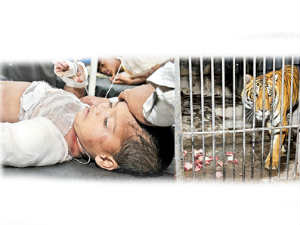 Tiger bites off toddler's forearm at Bellary zoo Tiger bites off toddler's forearm at Bellary zoo