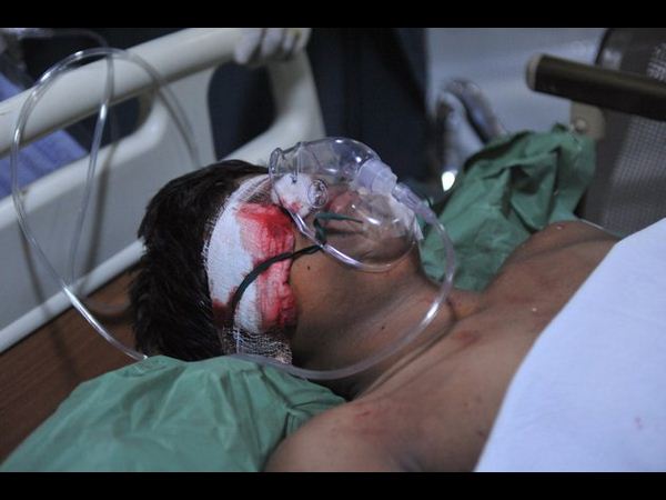 పేలుళ్ల ఫొటోలు: రక్తసిక్తం, హాహాకారాలు