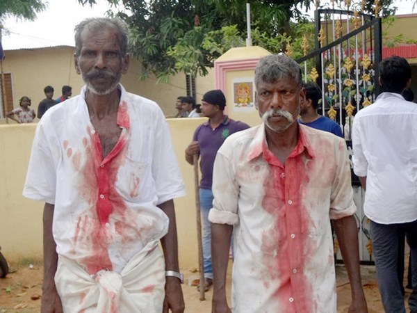 రక్తం కారింది