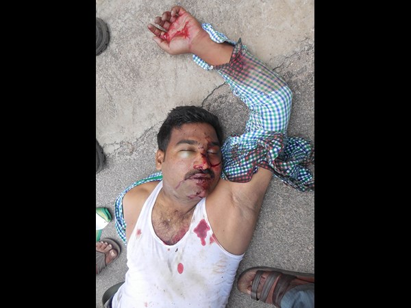 కారు డ్రైవర్ చేస్తూ మృతి