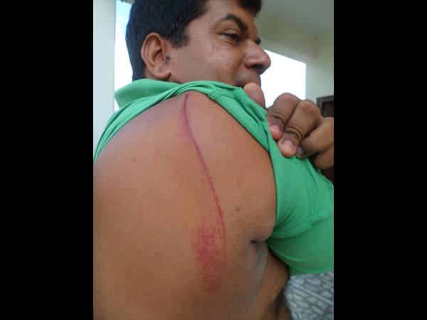 గాయపడిన ఇంటి యజమాని