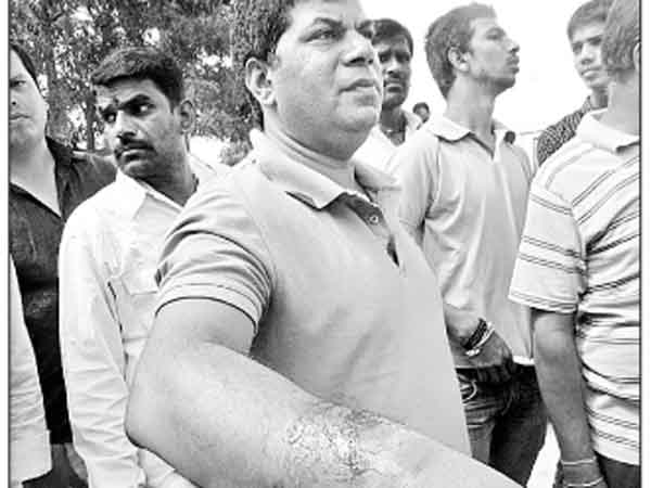 ఎదురుదాడిలో గాయాలు..