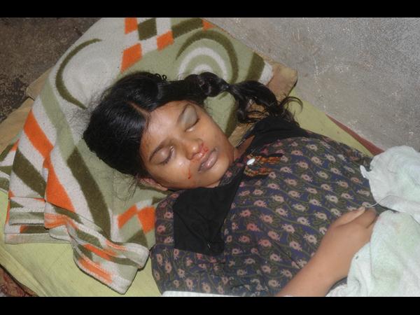 చెట్టు కూలి బాలిక మృతి