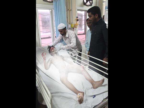  చికిత్స పొందుతూ మెహిదీపట్నం బాలుడు ముస్తఫా మృతి