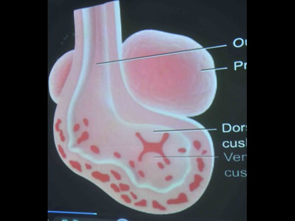 గర్భస్థ శిశువుకు సర్జరీ