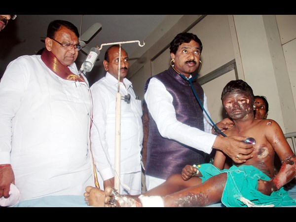 కాలిన గాయాలతో విద్యార్ధులు.. రాజయ్య పరామర్శ కాలిన గాయాలతో విద్యార్ధులు.. రాజయ్య పరామర్శ