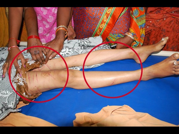 బాధితురాలు