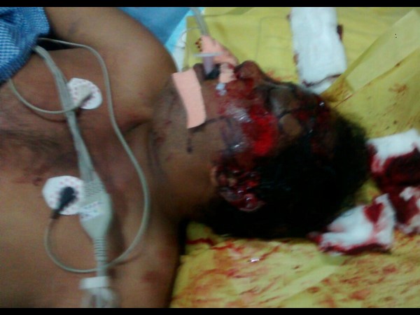  Lady techie dead in a road accident