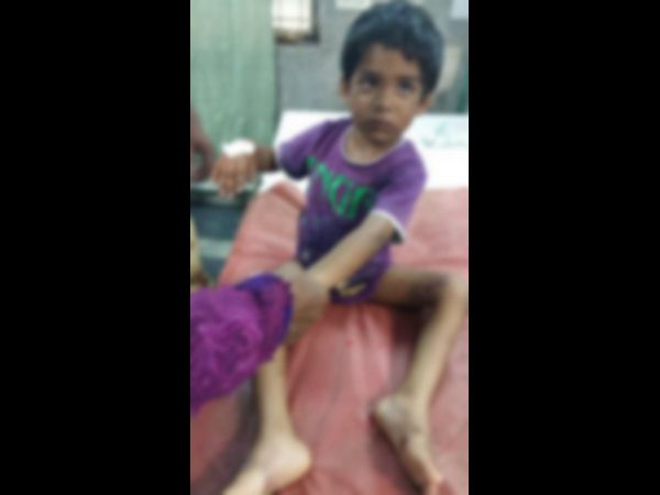  డబ్బు కోసం కొడుక్కి వాతులు పెట్టిన తల్లి