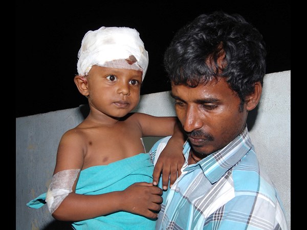 27 కుక్కకాటు కేసులు