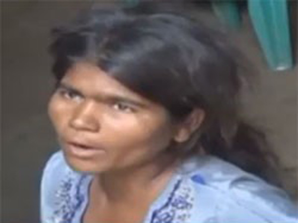 woman injured in chain snatcher attack in hyderabad woman injured in chain snatcher attack in hyderabad