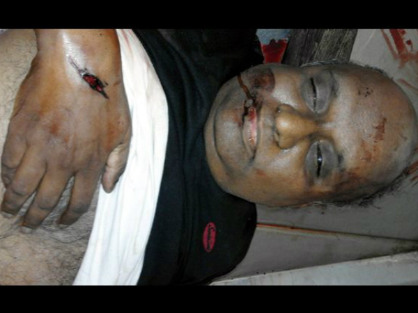 Man dead in a current pole fallen in tirumalagiri, Secunderabad